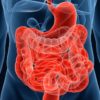 ¿Qué es la costra intestinal? +Limpieza para eliminarla
